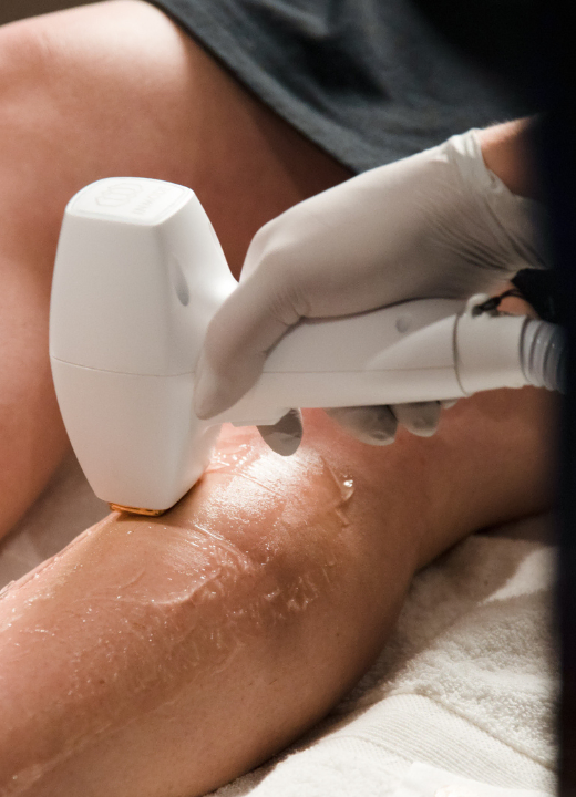 Laser Hair Removal Orem image 1