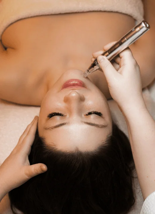 Microneedling Near Me image 1