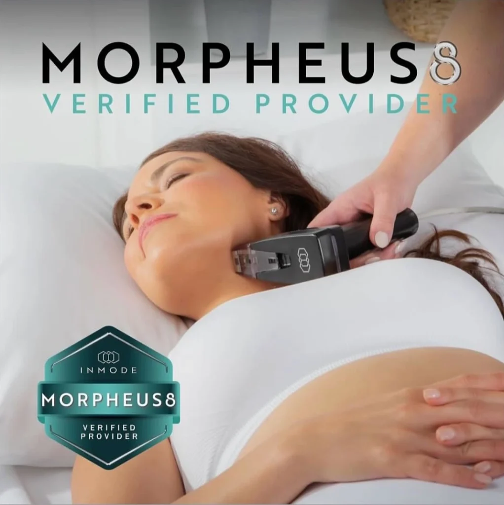 Morpheus8 Face Near Me image 1